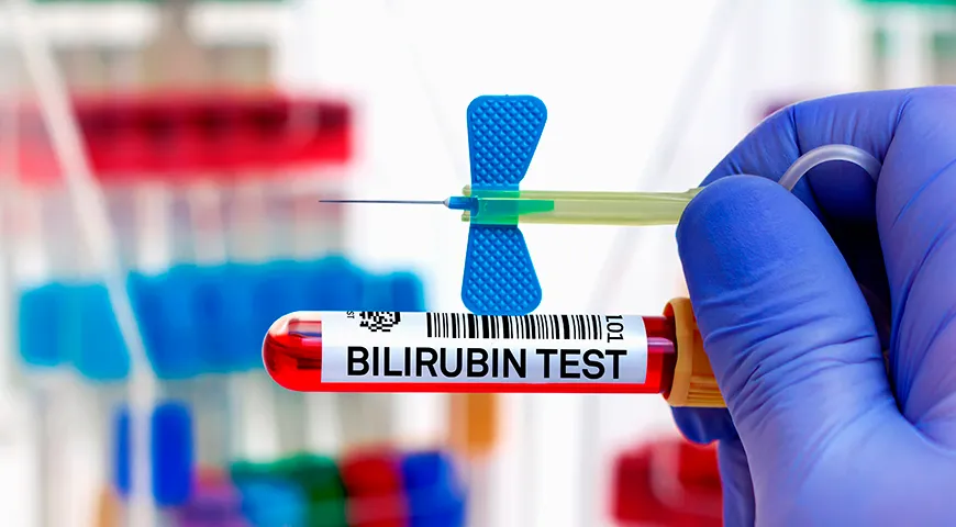 Normalerweise sollte der Bilirubinwert bei einem Erwachsenen 20,5 µmol/l nicht überschreiten